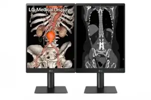 LG 21.3'' 3MP IPS DIAGNOSTIC MONITOR